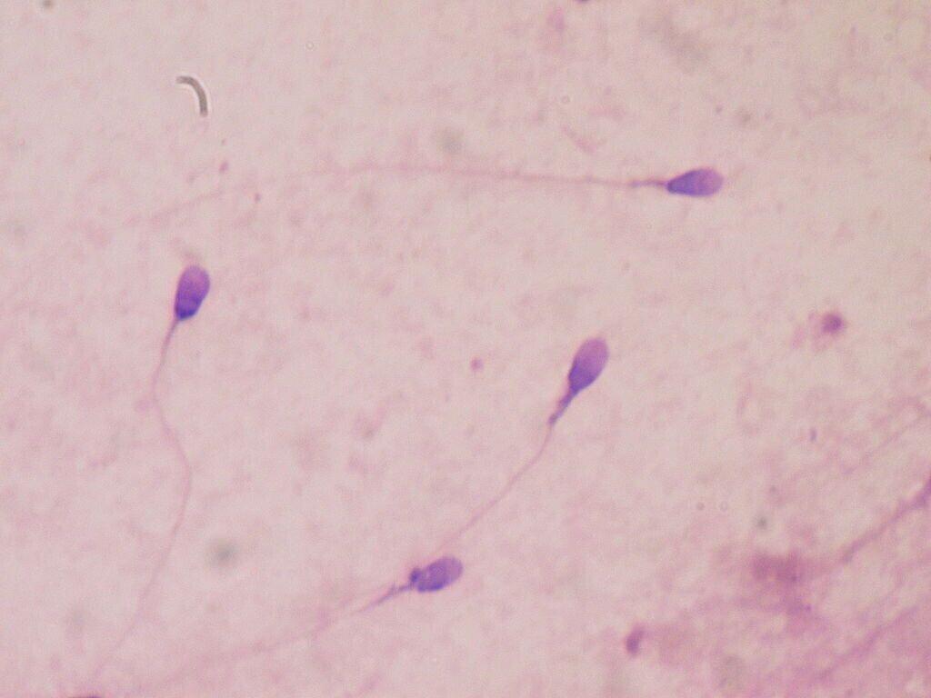 Spermatosoidid.