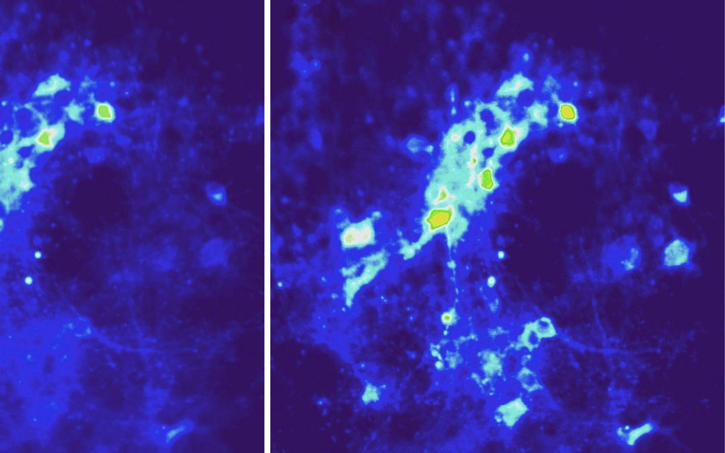 Ajuaktiivsus enne ja pärast nanoosakeste magnetväljaga mõjutamist.