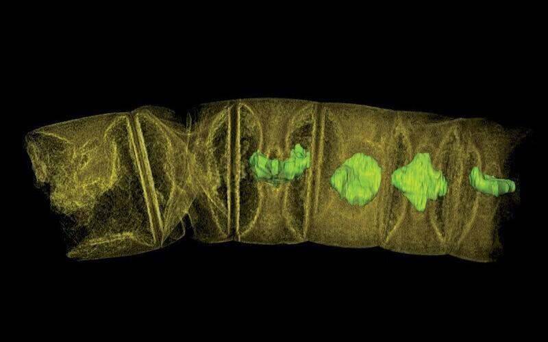 Sünkrotroni all koostatud vetika rekonstruktsioon.