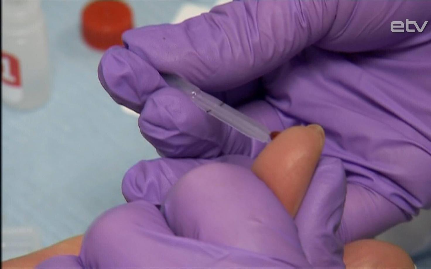 Тест на ВИЧ