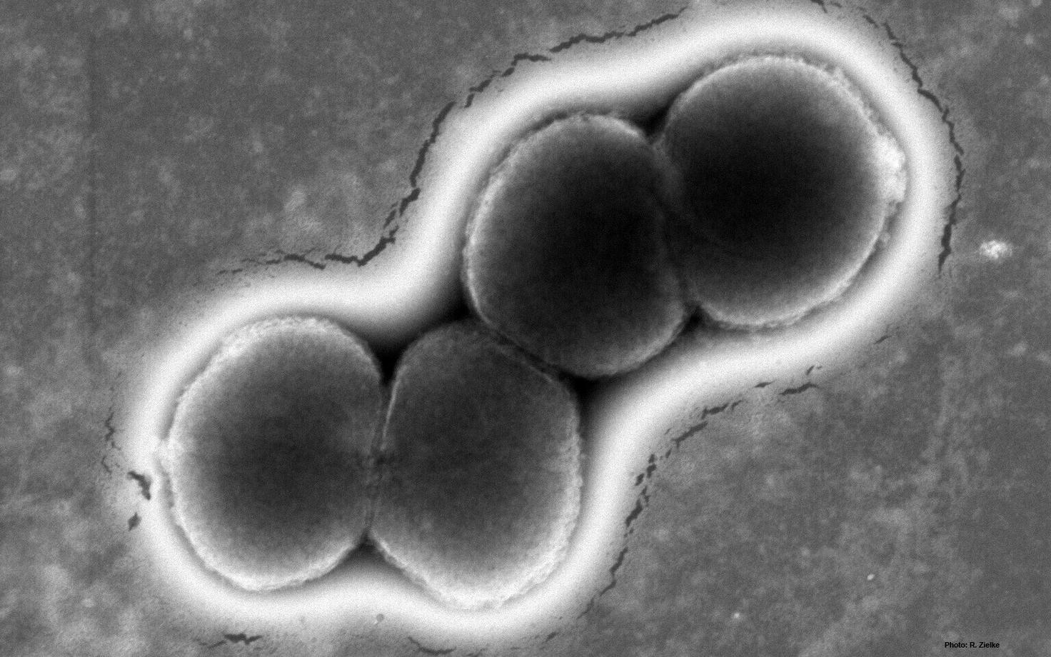 Neisseria gonorrhoeae ehk gonokokki bakter