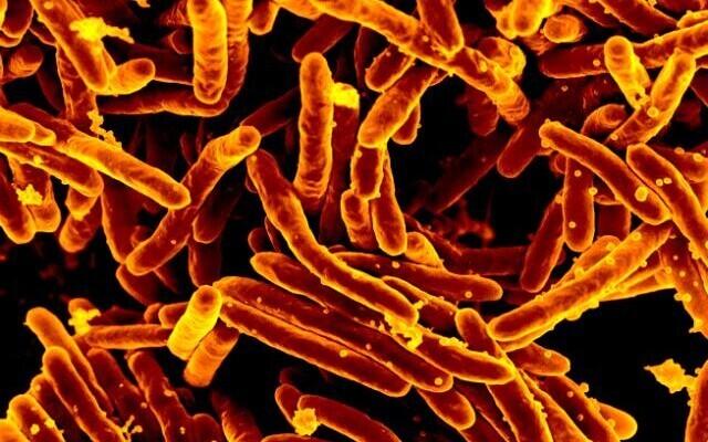 Teadlased suutsid saada jagu bakteri Mycobacterium smegmantis tekitatud nakkusest.