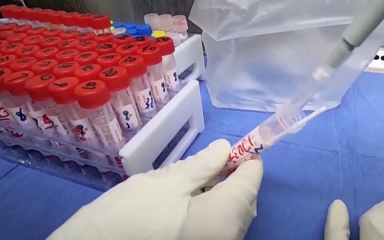 Koroonaviiruse testimine laboris.