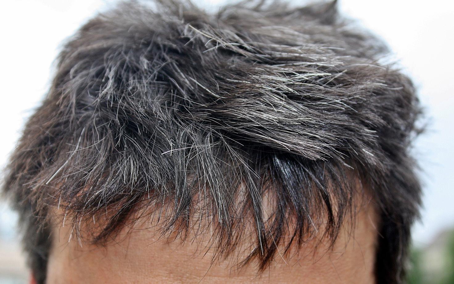 Kui hiljutised hiirte uuringud viitavad, et halliksminek on pöördumatu, siis inimeste puhul paistab olukord olema muutlikum.