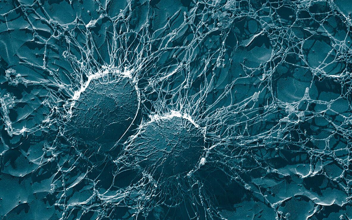 Staphylococcus aureus 50 000-kordses suurenduses.