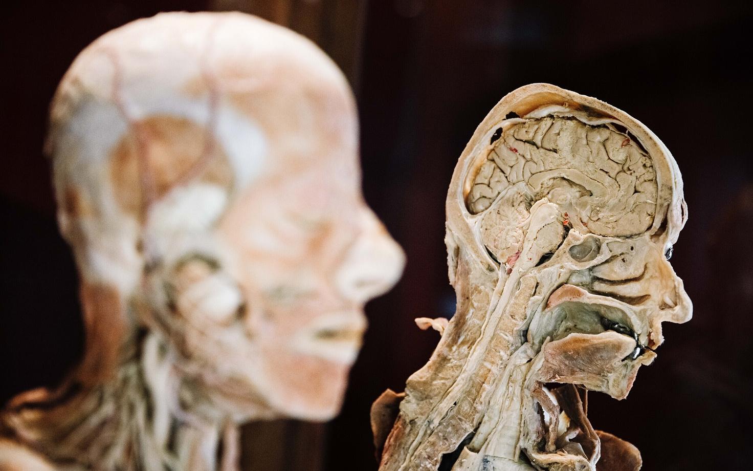 Skisofreenia spektrihäire esineb maailmas üle 23 miljonil inimesel.