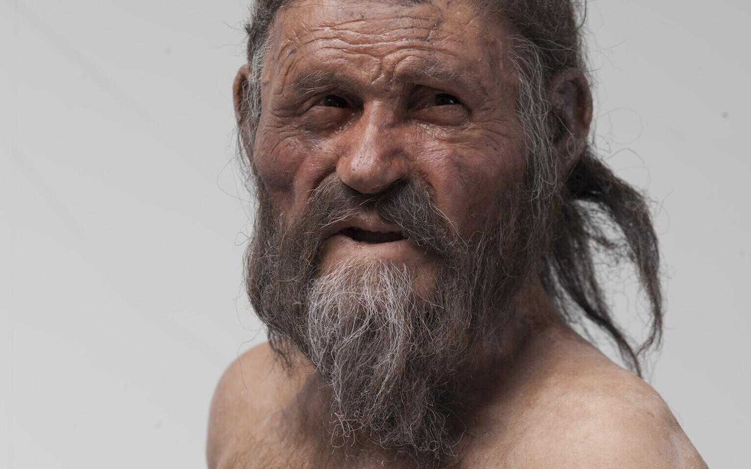 Jäämees Ötzi kannatas tõenäoliselt inimese papilloomviiruse HPV16 all.