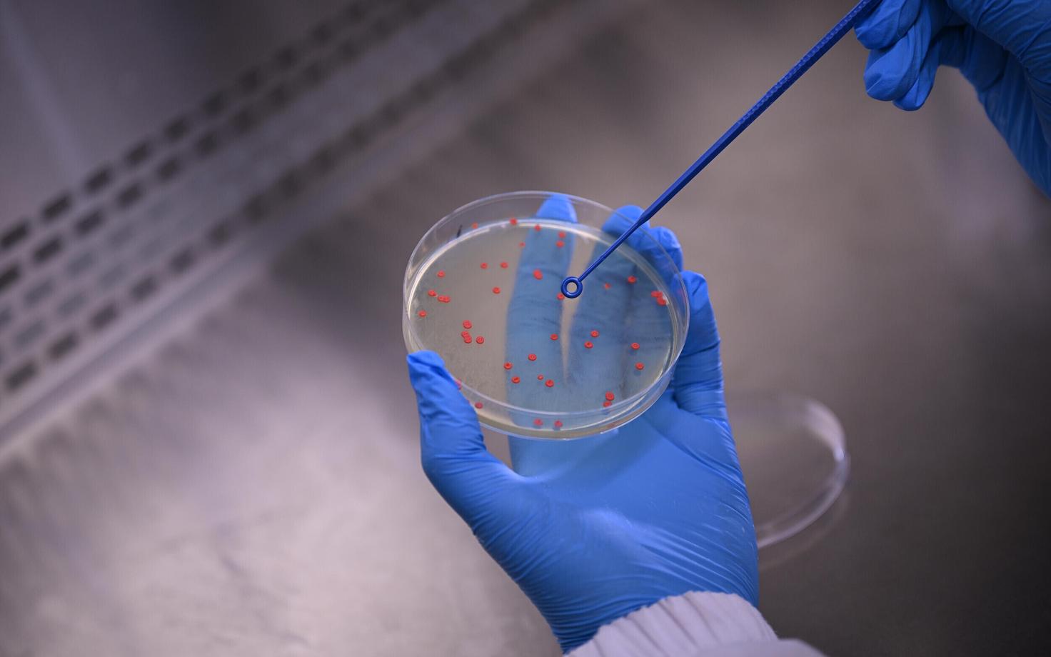 Pärm Rhodontula toruloides