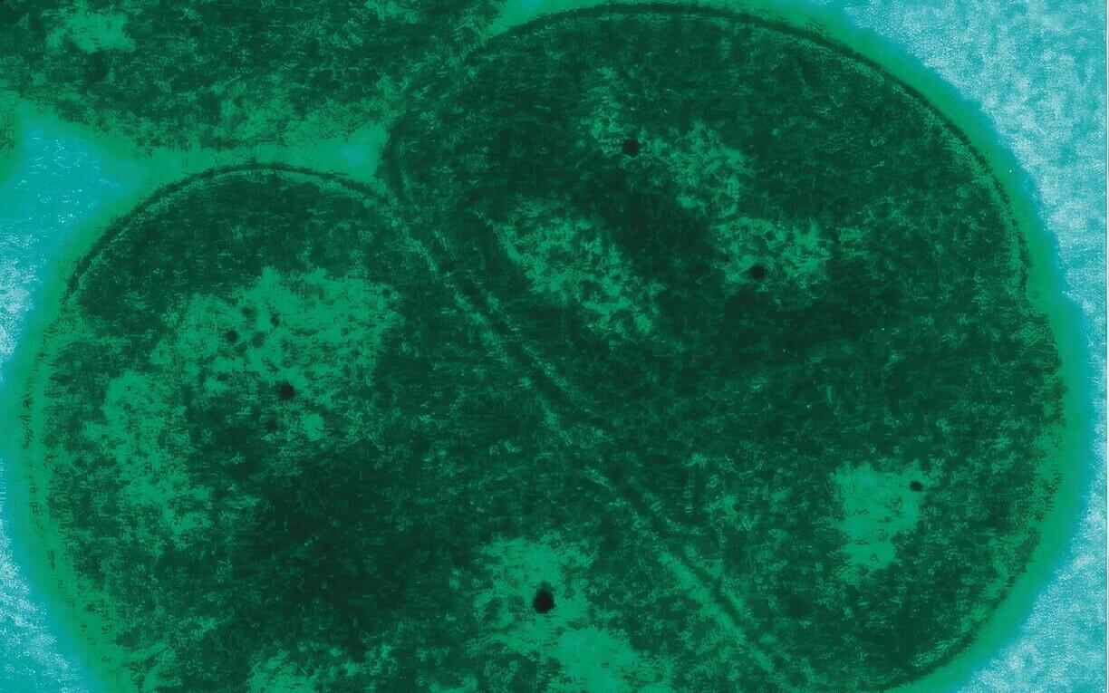 Deinococcus radiodurans mikroskoobi all.
