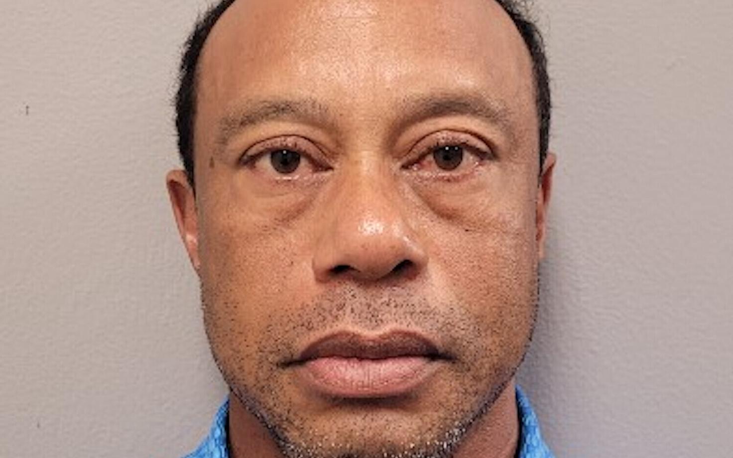 Golfilegend Tiger Woods politsei tehtud fotol pärast autoavariid.